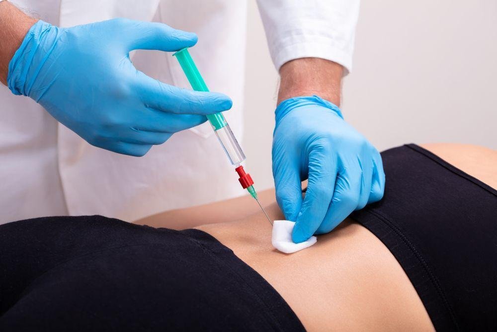 Cortisontherapie